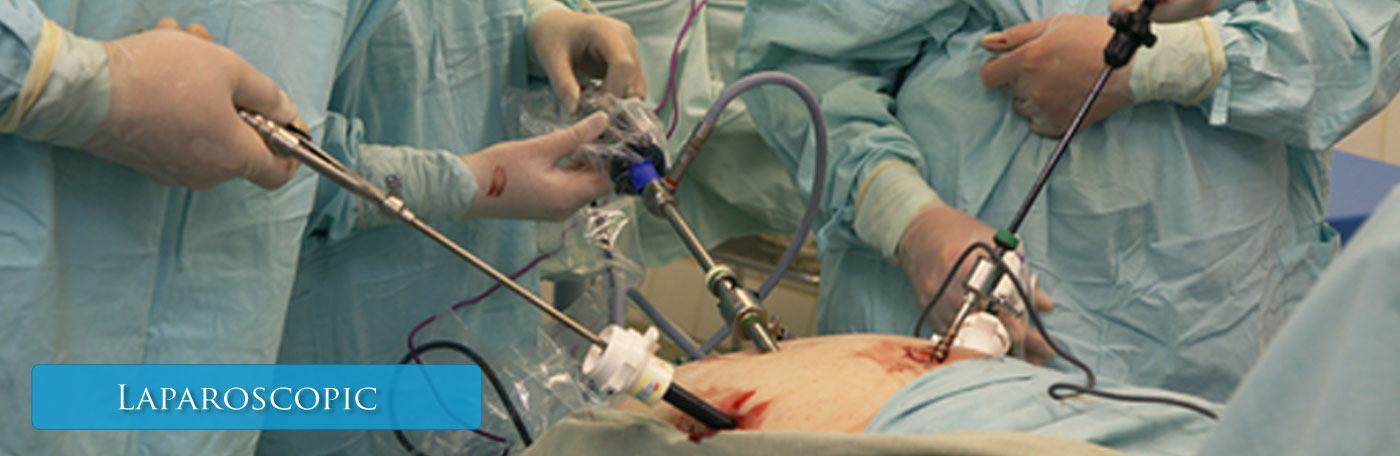 Laparoscopic Umbilical Hernia Repair Punjab